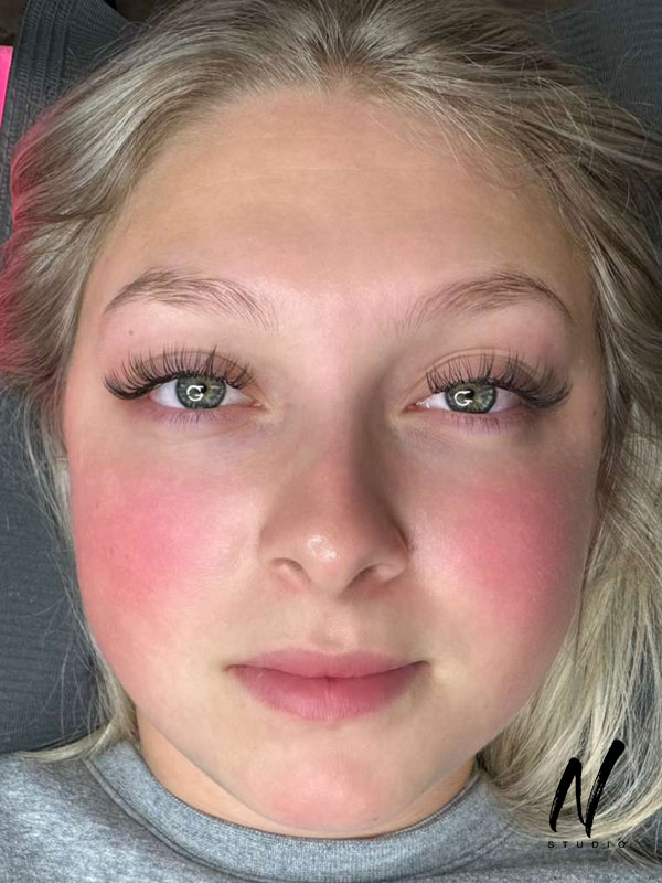 After lashes